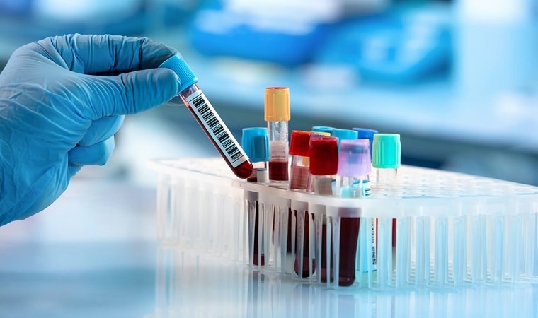 Yeni kan testi 18 farklı kanser türünü en erken evrede tespit ediyor